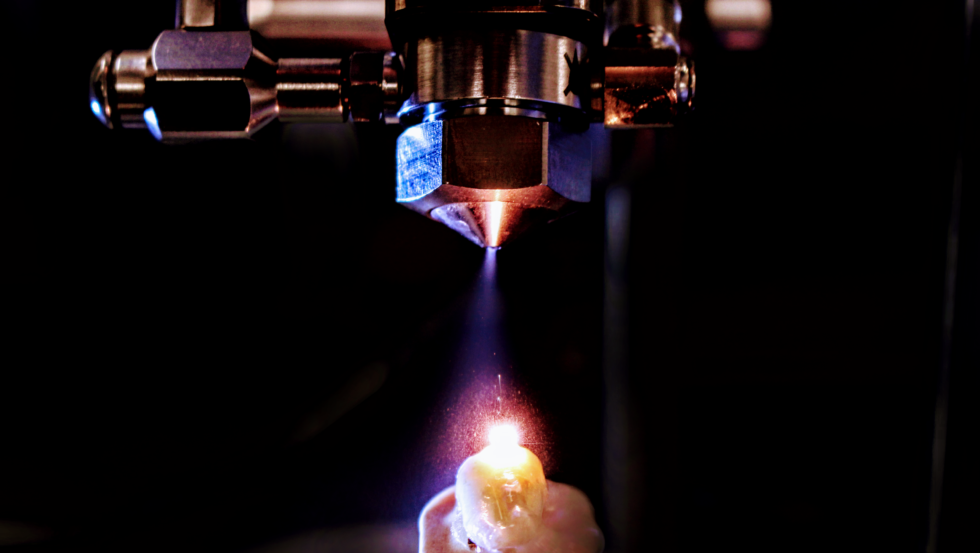 Access Laser Interview with the University of Washington School of